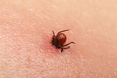 Tick Identification in your area